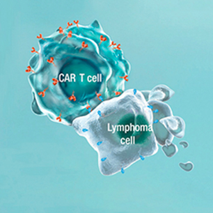 CAR T and Lymphoma cells