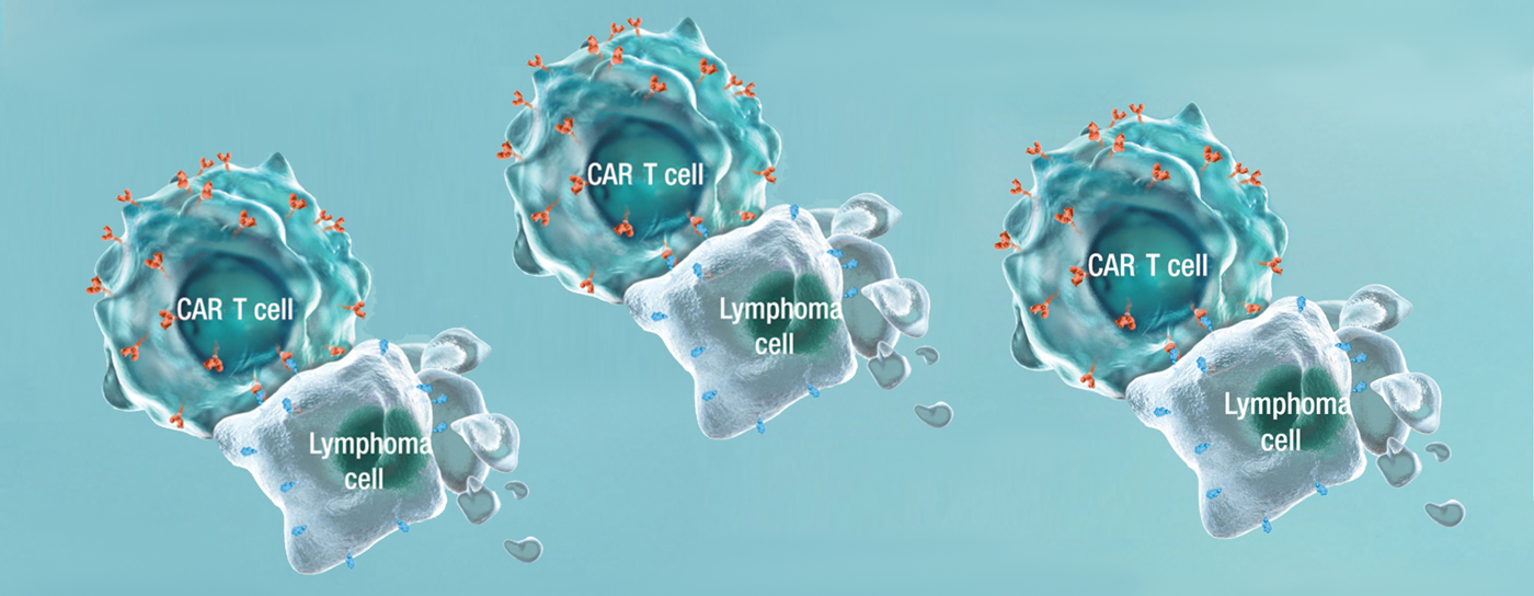 Advantages Of Car T Cell Therapy Rutgers Cancer Institute Of New Jersey